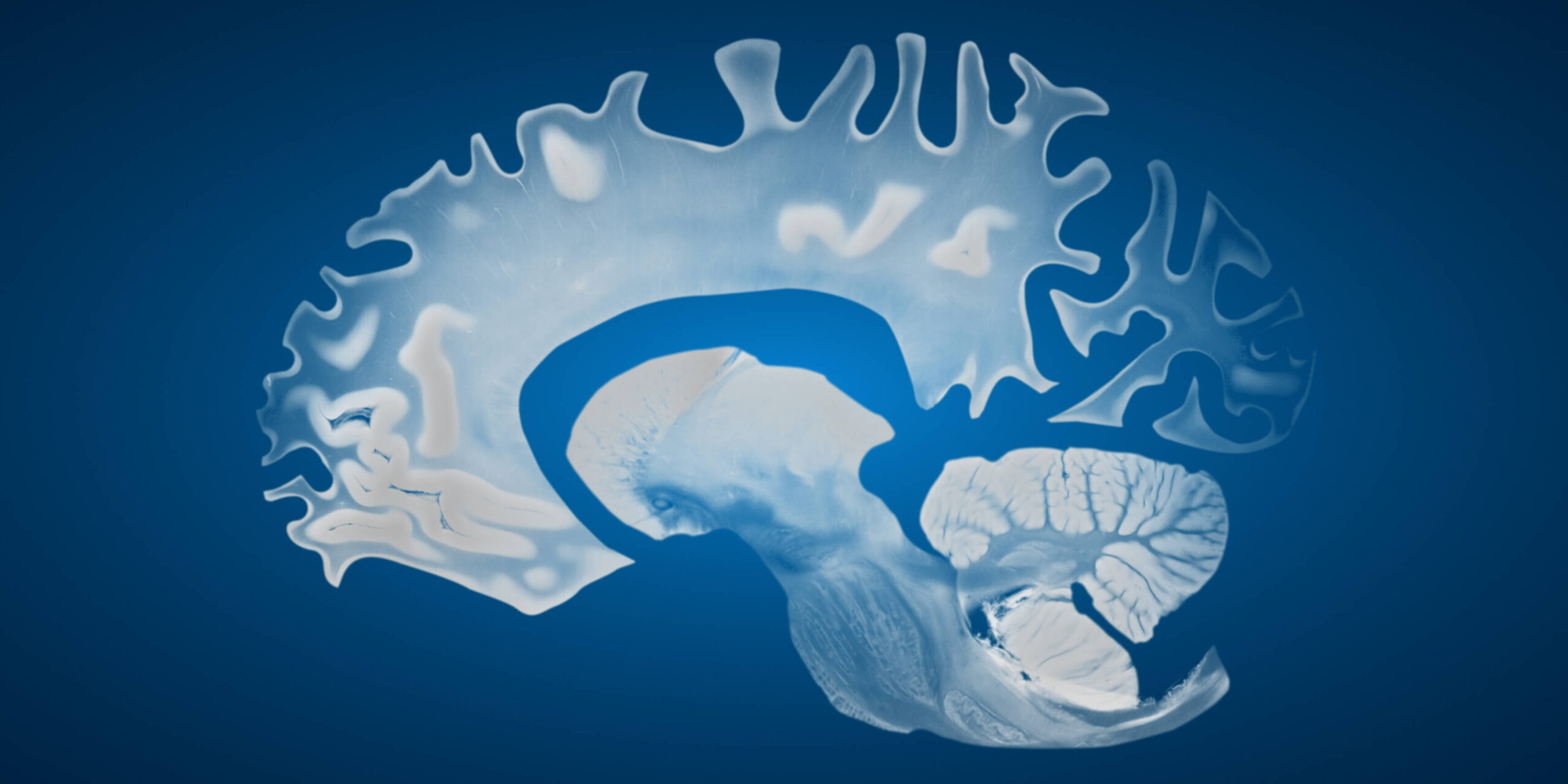 The Biggest Myths About Alzheimer’s blog post image