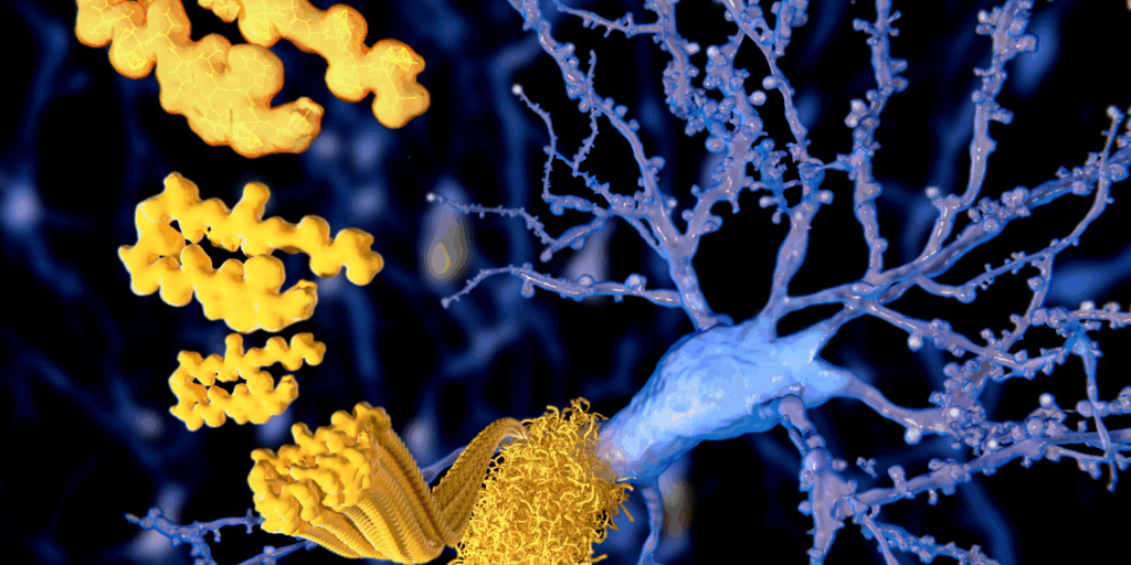 alzheimers drugs